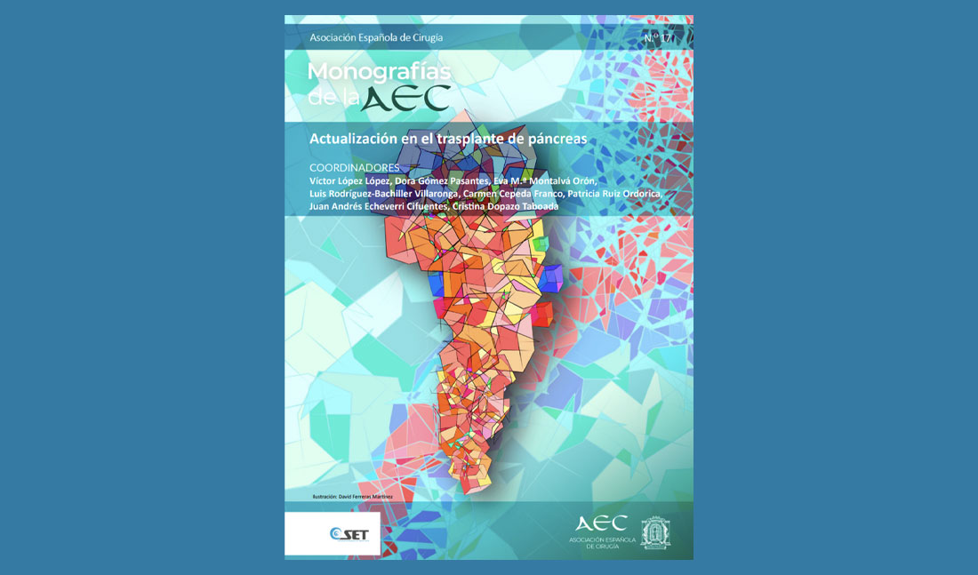 La Asociación Española de Cirugía publica la guía más completa sobre el trasplante de páncreas